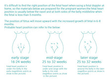 Load image into Gallery viewer, Sonoline C1 Fetal Doppler Back-light LCD Baby heart monitor