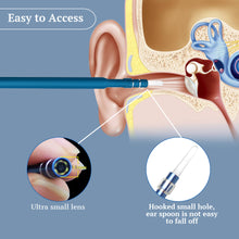 Load image into Gallery viewer, Ear Cleaning Endoscope Spoon Diagnostic Tool Ear Cleaner 3 in 1