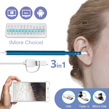 Load image into Gallery viewer, Ear Cleaning Endoscope Spoon Diagnostic Tool Ear Cleaner 3 in 1